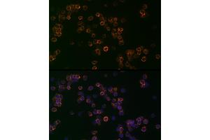 Immunofluorescence analysis of Jurkat cells using CD99 Rabbit pAb (ABIN3022730, ABIN3022731, ABIN3022732, ABIN1512728 and ABIN6219199) at dilution of 1:25 (40x lens). (CD99 antibody  (AA 23-185))