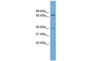 Image no. 1 for anti-Multiple Endocrine Neoplasia 1 (MEN1) (AA 351-400) antibody (ABIN6744537)