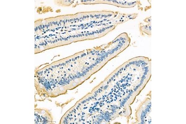 TREH antibody