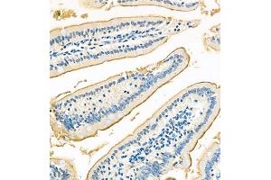 Immunohistochemistry of paraffin embedded mouse jejunum using Treh (ABIN7076006) at dilution of 1:700 (320x lens) (TREH antibody)