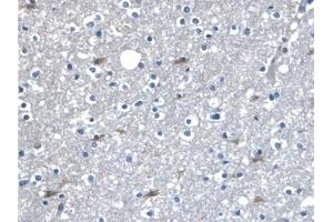 Detection of β-catenin in Human Cerebrum Tissue using Polyclonal Antibody to Beta Catenin (β-catenin) (beta Catenin antibody  (AA 439-675))