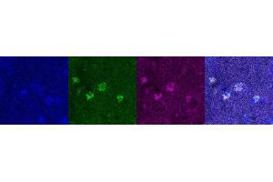 Immunohistochemistry (IHC) image for anti-Oligodendrocyte Lineage Transcription Factor 2 (OLIG2) antibody (ABIN7456327) (OLIG2 antibody)