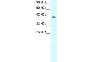 MMP19 Antikörper  (N-Term)