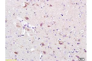 CACNA1G antibody  (AA 901-1000)