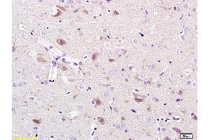 Formalin-fixed and paraffin-embedded rat brain labeled with Anti-CACNA1G/Cav3. (CACNA1G antibody  (AA 901-1000))