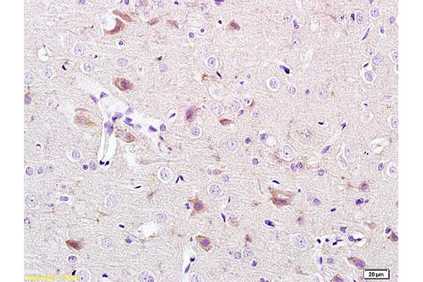 CACNA1G antibody  (AA 901-1000)