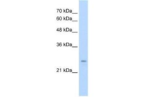 WB Suggested Anti-IER2 Antibody Titration:  0.