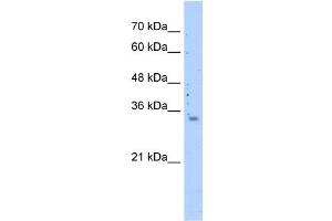 WB Suggested Anti-MRPS15 Antibody Titration: 0. (MRPS15 antibody  (N-Term))