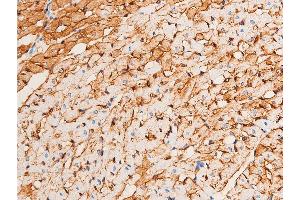 Immunohistochemistry (IHC) image for anti-Checkpoint Kinase 1 (CHEK1) (pSer296) antibody (ABIN6256251)