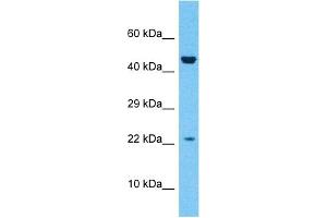 Host:  Rabbit  Target Name:  ZN576  Sample Type:  Fetal Liver lysates  Antibody Dilution:  1ug/ml
