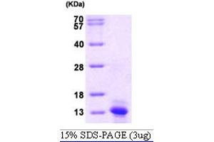 SDS-PAGE (SDS) image for Chemokine (C-C Motif) Ligand 2 (CCL2) (AA 24-99) protein (His tag) (ABIN666739) (CCL2 Protein (AA 24-99) (His tag))