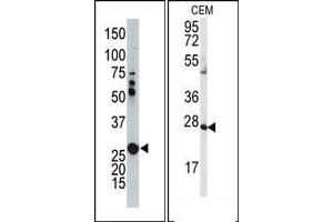 Image no. 1 for anti-Adenylate Kinase 2 (AK2) (N-Term) antibody (ABIN360624) (Adenylate Kinase 2 antibody  (N-Term))