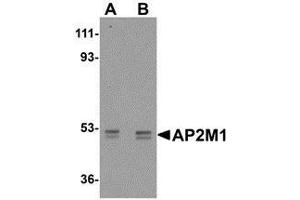 Western blot analysis of AP2M1 in human kidney tissue lysate with AP30054PU-N AP2M1 antibody at (A) 1 and (B) 2 μg/ml. (AP2M1 antibody  (C-Term))