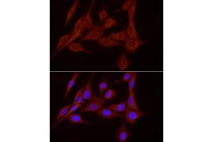 Immunofluorescence analysis of NIH/3T3 cells using SLC7/xCT Rabbit pAb (ABIN6134319, ABIN6148046, ABIN6148047 and ABIN6217771) at dilution of 1:200 (40x lens). (SLC7A11 antibody  (AA 150-250))