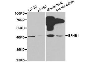 Western blot analysis of extracts of various cell lines, using EFNB1 antibody. (Ephrin B1 antibody  (AA 28-237))