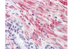 Immunohistochemistry with Anti-Glycogen Synthase antibody Tissue: Human Prostate Fixation: formalin-fixed, paraffin-embedded tissue Antigen retrieval: heat-induced Primary antibody: 5 µg/ml Staining: antibody as precipitated red signal with a hematoxylin purple nuclear counterstain. (Glycogen Synthase 1 antibody  (pSer641))