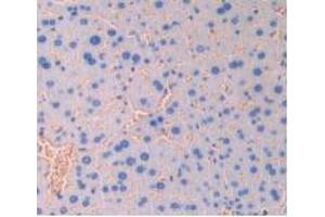 Figure. (CD47 antibody  (AA 18-219))