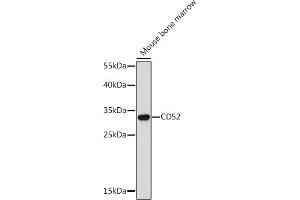 Western blot analysis of extracts of Mouse bone marrow, using CD52 Rabbit pAb (ABIN7266207) at 1:300 dilution. (CD52 antibody  (AA 1-61))