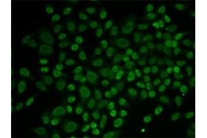 Immunofluorescence analysis of MCF-7 cells using RL2 antibody (ABIN6132938, ABIN6146651, ABIN6146653 and ABIN6217641). (ARIP4 antibody  (AA 1178-1467))