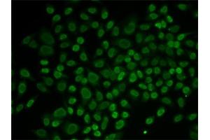 Immunofluorescence analysis of MCF-7 cells using RL2 antibody (ABIN6132938, ABIN6146651, ABIN6146653 and ABIN6217641). (ARIP4 antibody  (AA 1178-1467))