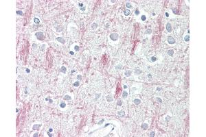 Anti-GPR125 antibody IHC staining of human brain, cortex. (GPR125 antibody  (AA 1098-1109))