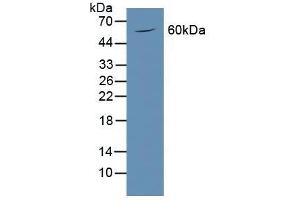 Detection of PODXL in Mouse Brain Tissue using Polyclonal Antibody to Podocalyxin (PODXL) (PODXL antibody  (AA 220-431))