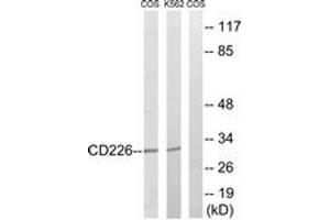 Western blot analysis of extracts from COS7/K562 cells, treated with PMA 125ng/ml 30' , using CD226/DNAM-1 (Ab-329) Antibody.
