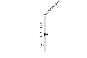 Anti-LRP1B Antibody at 1:2000 dilution + Recombinant protein Lysates/proteins at 20 μg per lane. (LRP1B antibody)