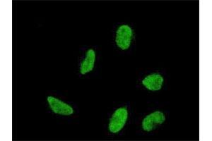 Immunofluorescence of monoclonal antibody to HOXA5 on HeLa cell. (HOXA5 antibody  (AA 171-270))