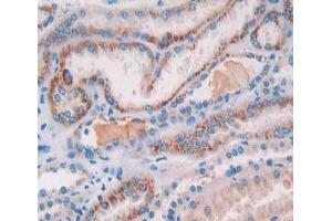 Used in DAB staining on fromalin fixed paraffin- embedded kidney tissue (COL18A1 antibody  (AA 1154-1335))
