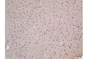 Formalin-fixed and paraffin embedded rat brain labeled with Rabbit Anti-XPB Polyclonal Antibody, Unconjugated (ABIN706031) at 1:200 followed by conjugation to the secondary antibody and DAB staining