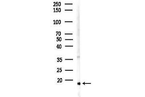 Western blot analysis of lysates from K562 cells(heat-shock,45 min treatment), using TUSC2 Antibody at 1/1000 dilution.
