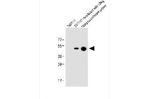 All lanes : Anti-His Tag Antibody at 1:1000 dilution Lane 1: 293T/17 whole cell lysate Lane 2: 293T/17 transfected with 12tag whole cell lysate Lane 3: 12tag recombinant protein Lysates/proteins at 1 μg per lane.