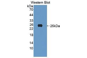 Western blot analysis of the recombinant protein. (EZH1 antibody  (AA 559-747))