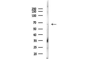 anti-Golgi-Associated, gamma Adaptin Ear Containing, ARF Binding Protein 2 (GGA2) (C-Term) antibody