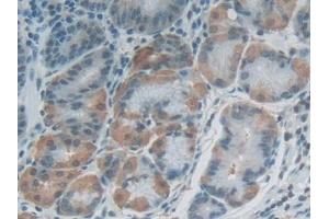 Detection of FLG2 in Human Stomach Tissue using Polyclonal Antibody to Filaggrin 2 (FLG2) (FLG2 antibody  (AA 1915-2143))