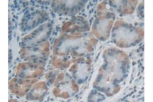 Detection of FLG2 in Human Stomach Tissue using Polyclonal Antibody to Filaggrin 2 (FLG2)