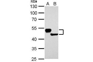 WB Image Cytokeratin 13 antibody detects KRT13 protein by Western blot analysis. (Cytokeratin 13 antibody)