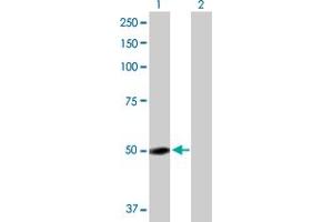 Western Blot analysis of GC expression in transfected 293T cell line by GC MaxPab polyclonal antibody. (Vitamin D-Binding Protein antibody  (AA 1-474))