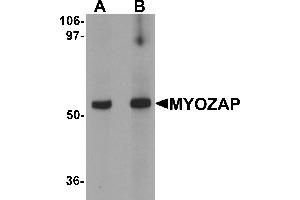 Western blot analysis of MYOZAP in rat kidney tissue lysate with MYOZAP antibody at (A) 1 and (B) 2 µg/mL. (MYZAP antibody  (C-Term))