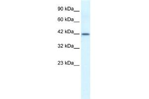 WB Suggested Anti-ESR2 Antibody Titration: 0. (ESR2 antibody  (N-Term))