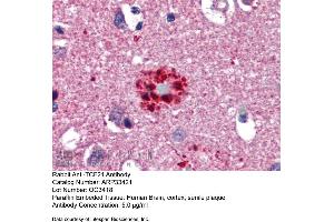 Immunohistochemistry with Human Brain, cortex, senile plaque tissue at an antibody concentration of 5. (TCF21 antibody  (N-Term))