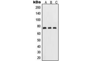 Western blot analysis of NF-kappaB p65 (pS311) expression in HeLa TNFa-treated (A), mouse kidney (B), PC12 UV-treated (C) whole cell lysates. (NF-kB p65 antibody  (pSer311))