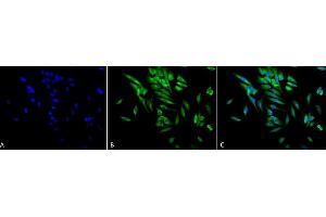 Immunocytochemistry/Immunofluorescence analysis using Mouse Anti-Hsp90 alpha/beta Monoclonal Antibody, Clone K41220A (ABIN361715 and ABIN361716). (HSP90 alpha/beta antibody  (AA 291-304))