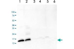 Western Blot analysis of (1) 25 ug whole cell extracts of Hela cells, (2) 15 ug histone extracts of Hela cells, (3) 1 ug of recombinant histone H2A, (4) 1 ug of recombinant histone H2B, (5) 1 ug of recombinant histone H3, (6) 1 ug of recombinant histone H4. (HIST3H2A antibody  (acLys5))