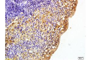 Formalin-fixed and paraffin embedded rat spleen labeled with Rabbit Anti phospho-Pyk2/PTK2B(Tyr402) Polyclonal Antibody, Unconjugated (ABIN745763) at 1:200 followed by conjugation to the secondary antibody and DAB staining (PTK2B antibody  (pTyr402))