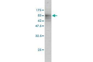 Western Blot detection against Immunogen (74. (SQSTM1 antibody  (AA 1-440))