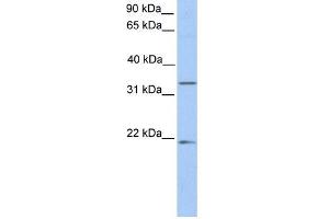 FUT6 antibody used at 1 ug/ml to detect target protein. (FUT6 antibody  (C-Term))