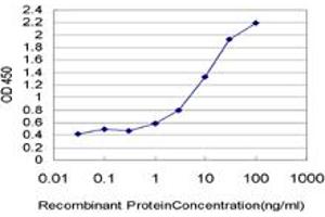 Detection limit for recombinant GST tagged KDM5B is approximately 0. (KDM5B antibody  (AA 231-319))