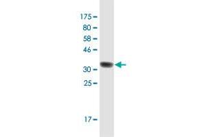 Western Blot detection against Immunogen (36. (RAB3B antibody  (AA 120-219))